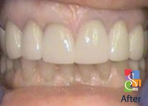 smile gallery image