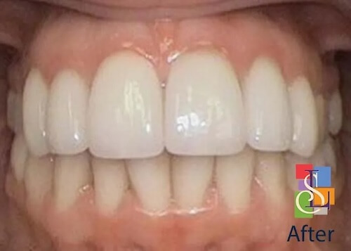 smile gallery image