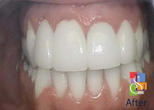 smile gallery image