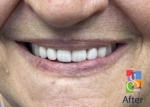 smile gallery image