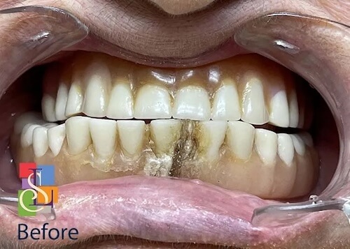 smile gallery image