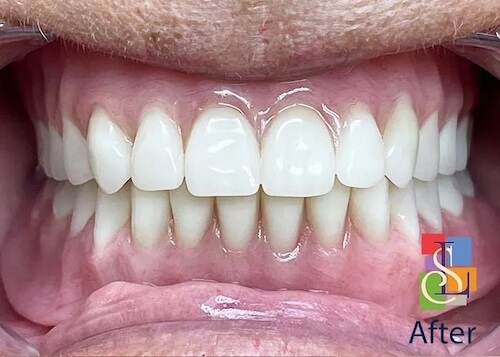 smile gallery image