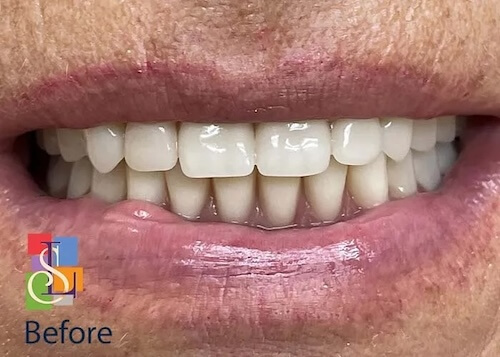 smile gallery image