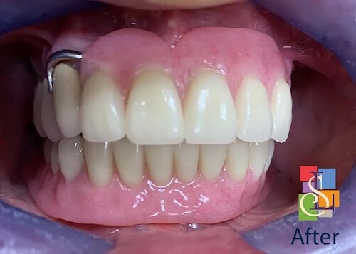 smile gallery image
