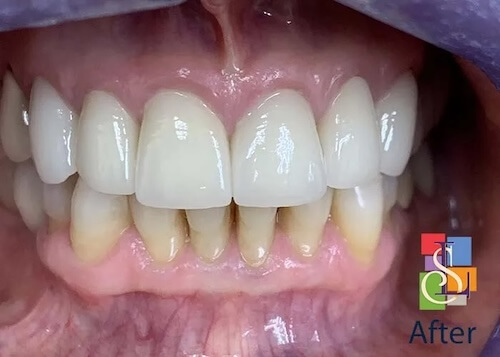 smile gallery image