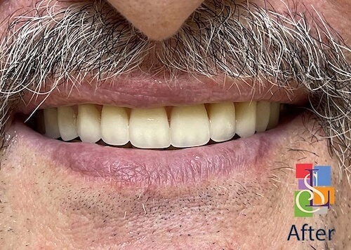 smile gallery image