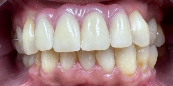 smile gallery image