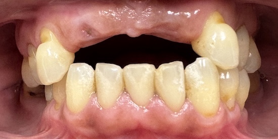 smile gallery image
