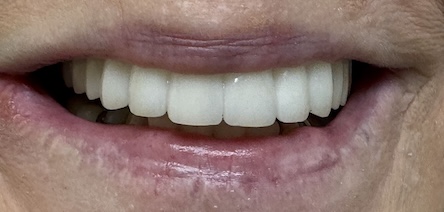 smile gallery image