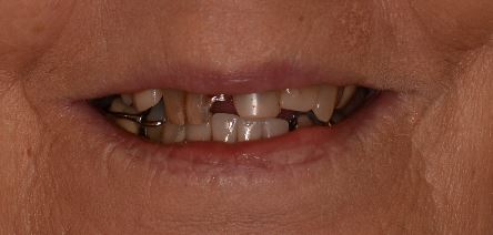 smile gallery image